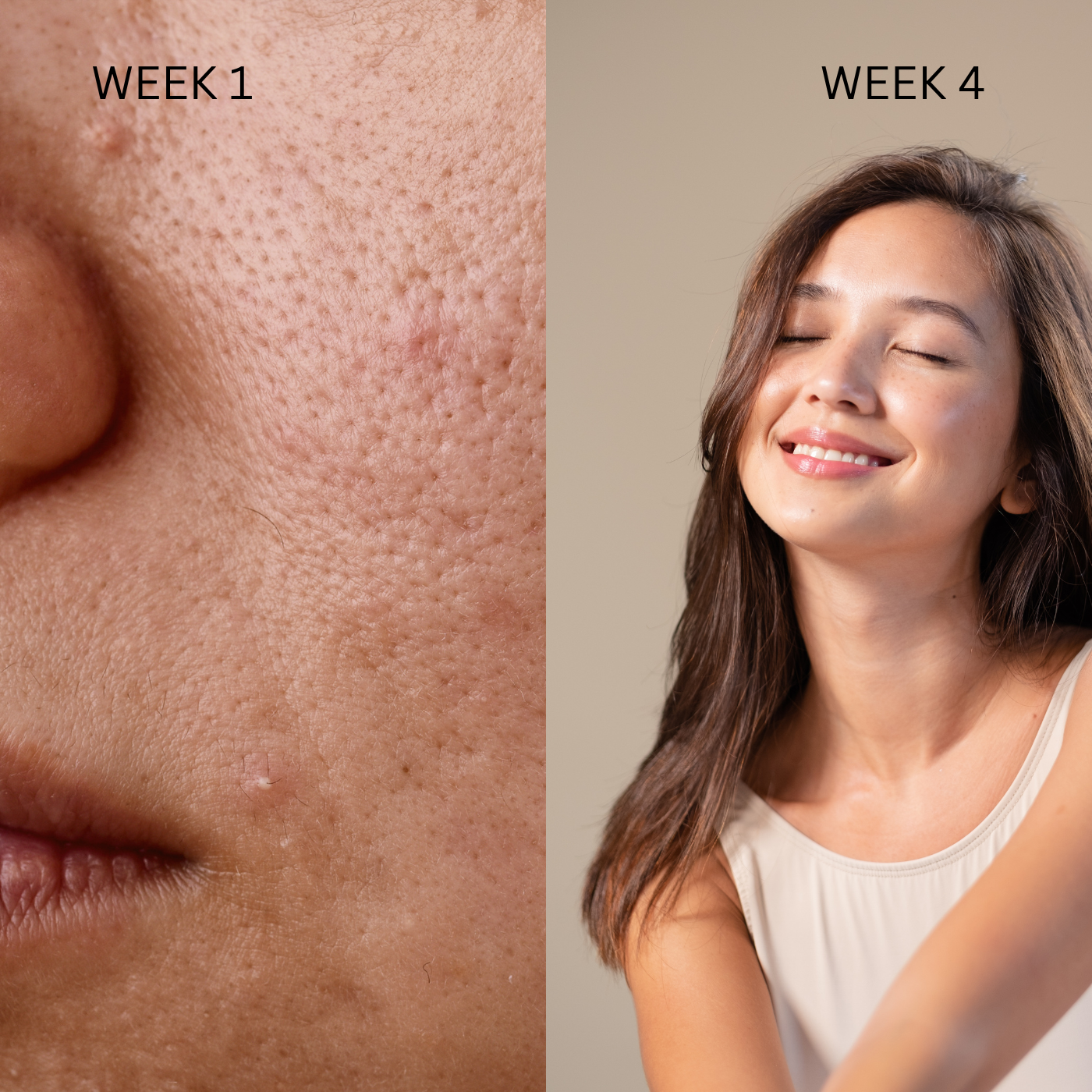 Hyaluronic Facial Treatment